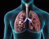 lungs-copd.jpg
