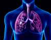 lungs-copd2.jpg